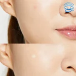 COSRX Acne Pimple Master Patch - Image 3